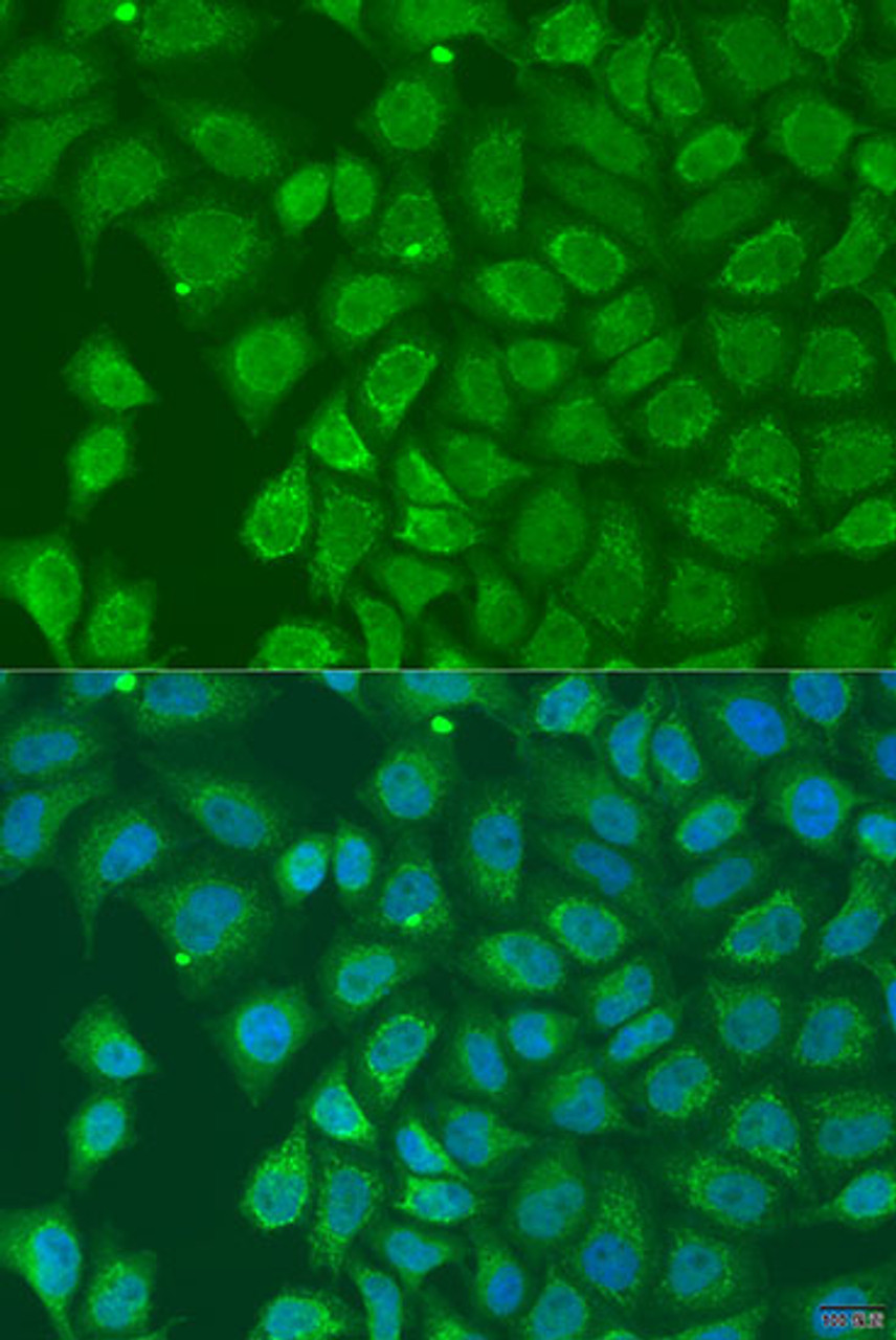 Immunofluorescence analysis of U2OS cells using HOXD10 Polyclonal Antibody at dilution of  1:100. Blue: DAPI for nuclear staining.