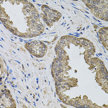 Immunohistochemistry of paraffin-embedded Human prostate using IGSF3 Polyclonal Antibody