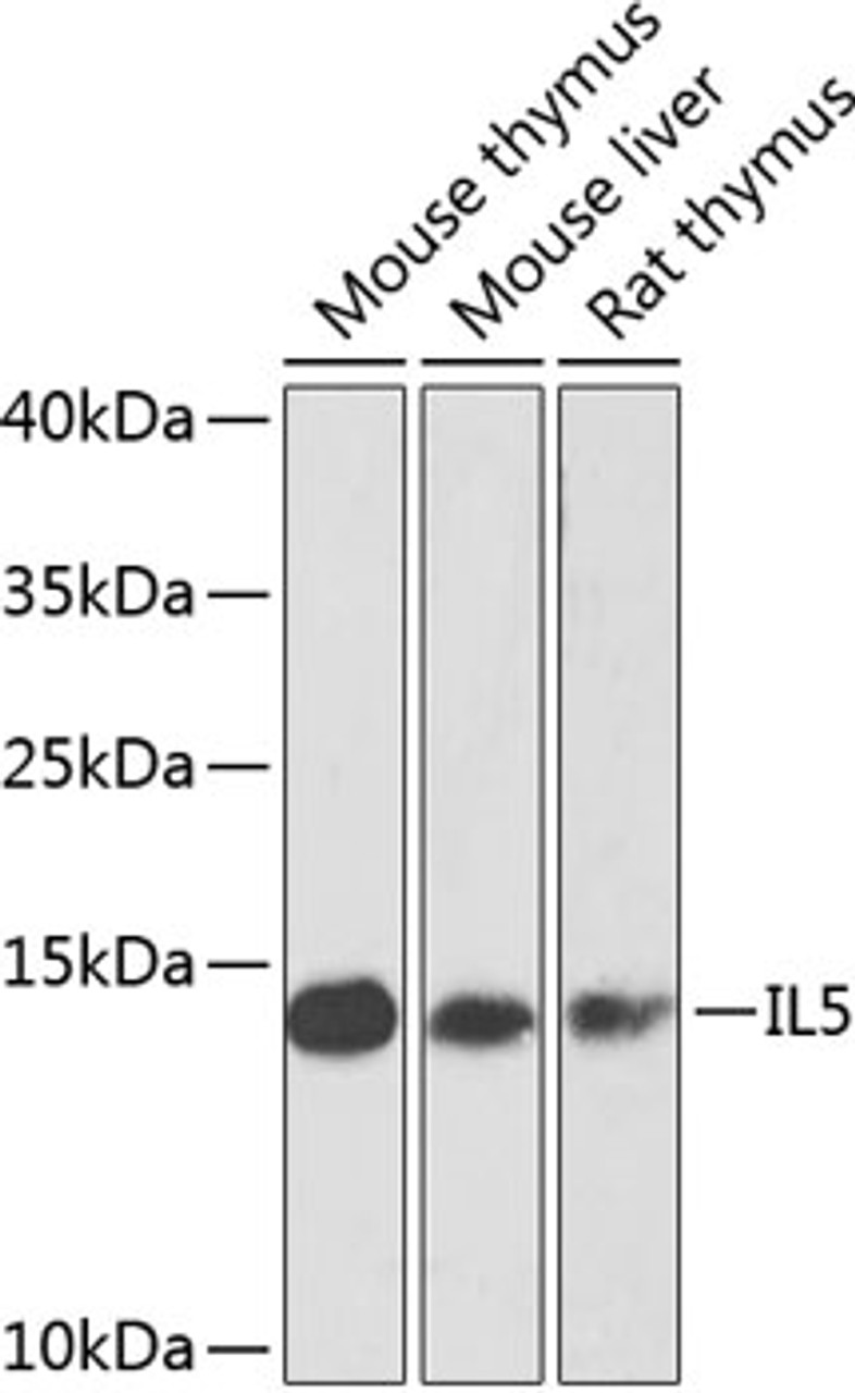 Western blot analysis of extracts of various cell lines using IL5 Polyclonal Antibody at dilution of 1:1000.