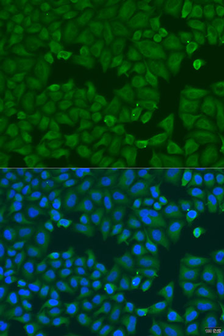 Immunofluorescence analysis of U2OS cells using KRT6B Polyclonal Antibody at dilution of  1:100. Blue: DAPI for nuclear staining.