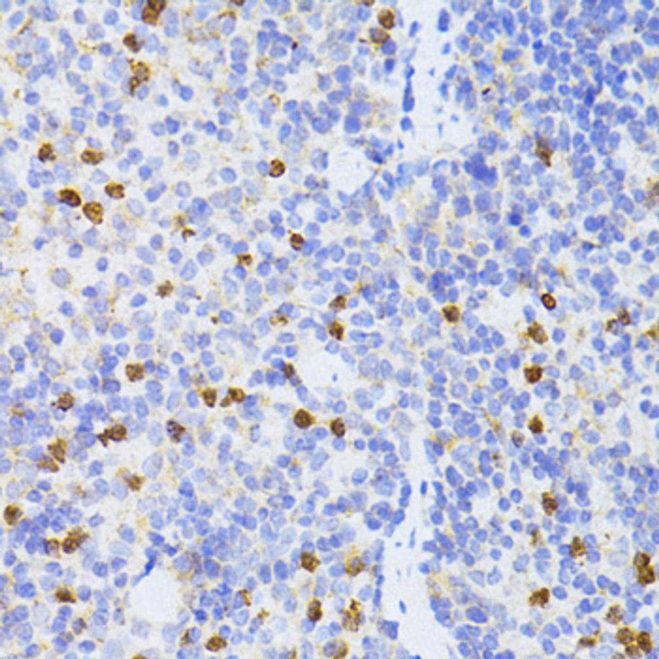 Immunohistochemistry of paraffin-embedded Mouse spleen using SMAD2 Polyclonal Antibody at dilution of  1:100 (40x lens).