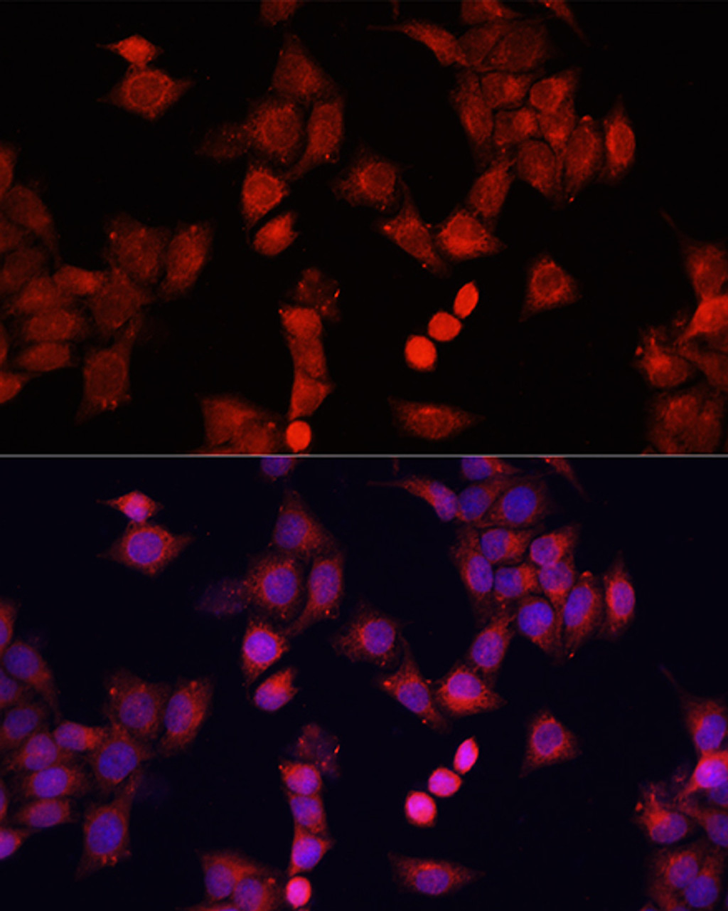 Immunofluorescence analysis of HeLa cells using SMAD2 Polyclonal Antibody at dilution of  1:100. Blue: DAPI for nuclear staining.