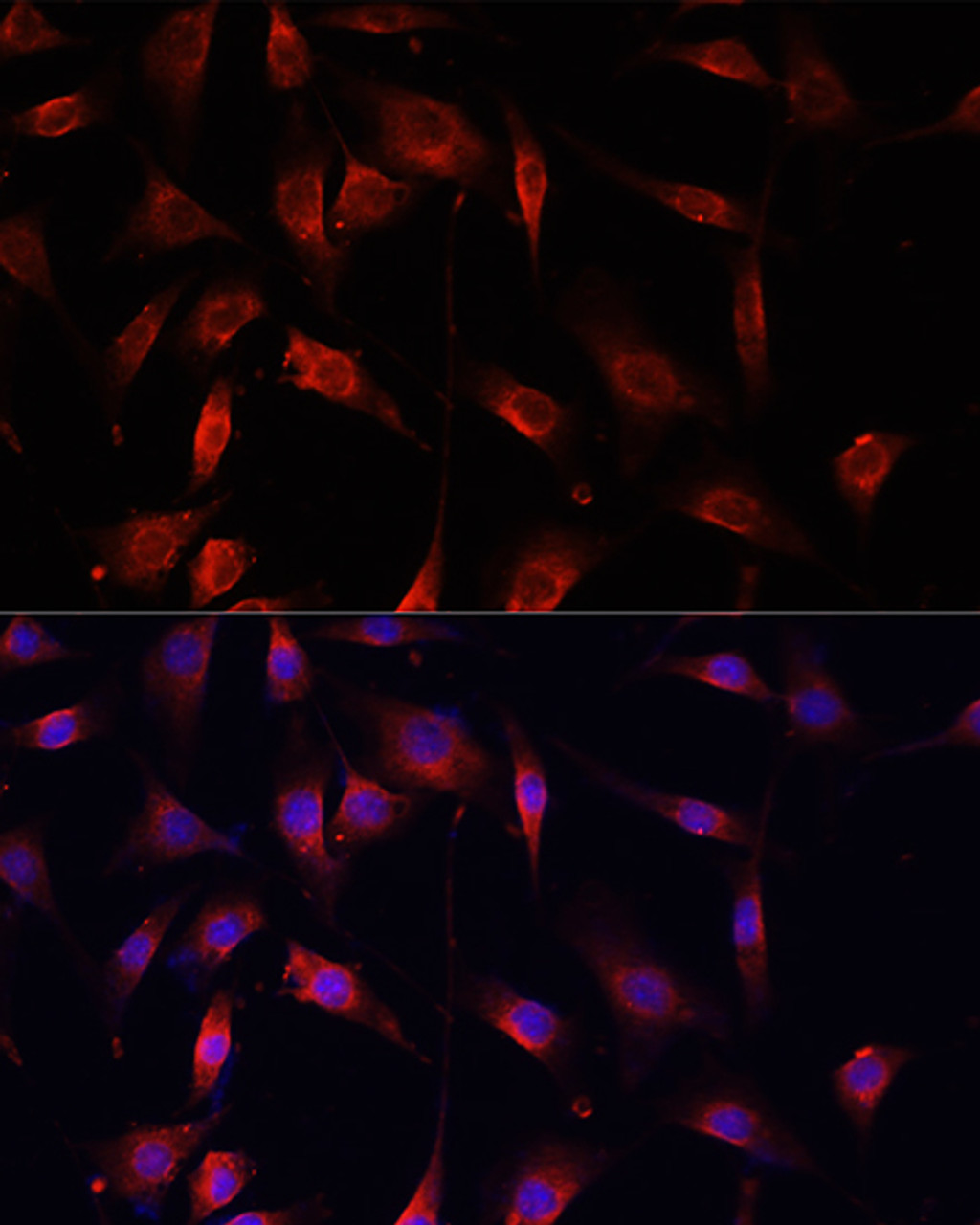 Immunofluorescence analysis of NIH/3T3 cells using SMAD2 Polyclonal Antibody at dilution of  1:100. Blue: DAPI for nuclear staining.