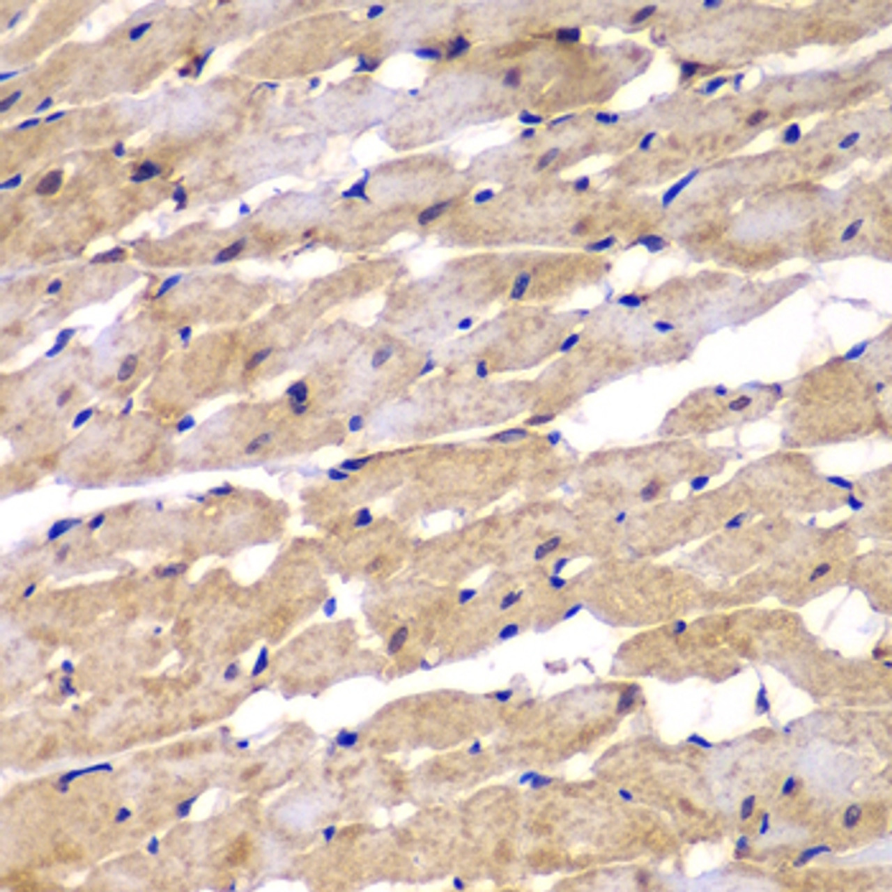 Immunohistochemistry of paraffin-embedded Rat heart using PSEN2 Polyclonal Antibody at dilution of  1:100 (40x lens).