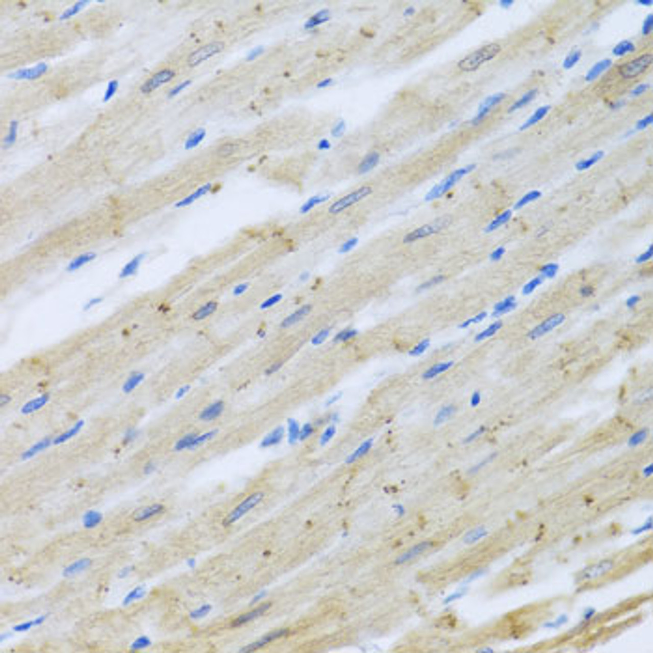 Immunohistochemistry of paraffin-embedded Rat heart using CLIP1 Polyclonal Antibody at dilution of  1:100 (40x lens).