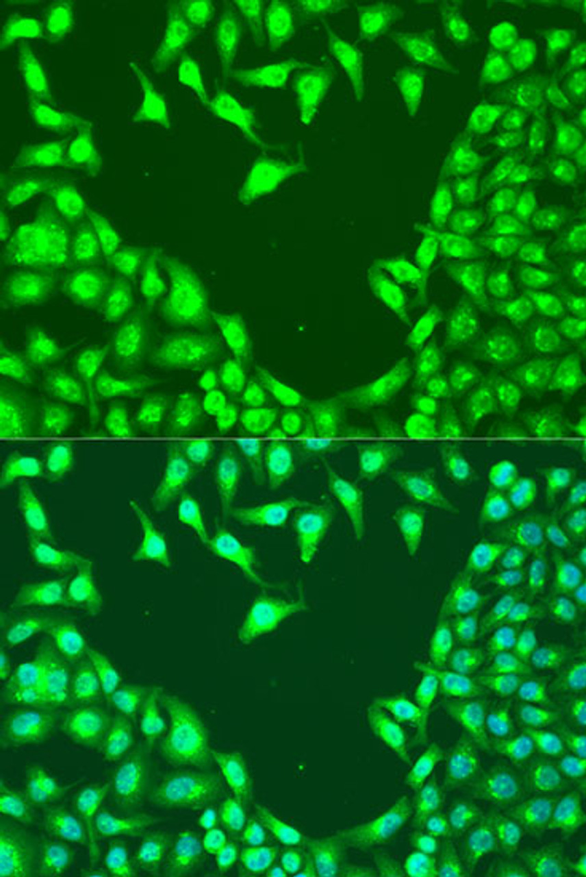 Immunofluorescence analysis of U2OS cells using MAP2K4 Polyclonal Antibody at dilution of  1:100. Blue: DAPI for nuclear staining.