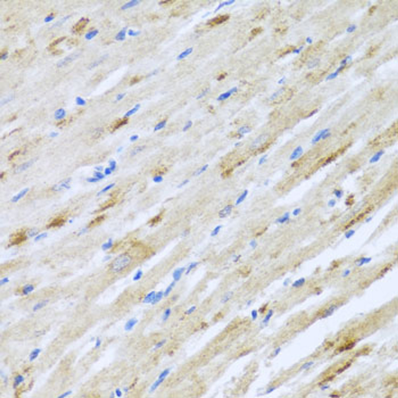 Immunohistochemistry of paraffin-embedded Rat heart using STRN Polyclonal Antibody at dilution of  1:100 (40x lens).