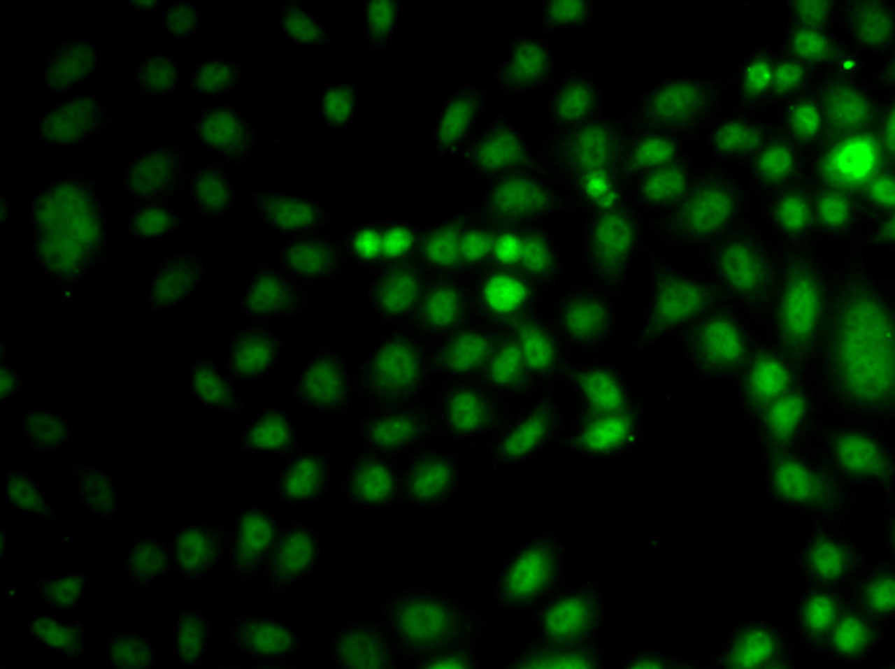 Immunofluorescence analysis of A549 cells using TRPS1 Polyclonal Antibody