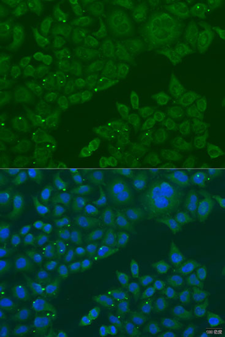 Immunofluorescence analysis of U2OS cells using B3GALNT1 Polyclonal Antibody at dilution of  1:100. Blue: DAPI for nuclear staining.