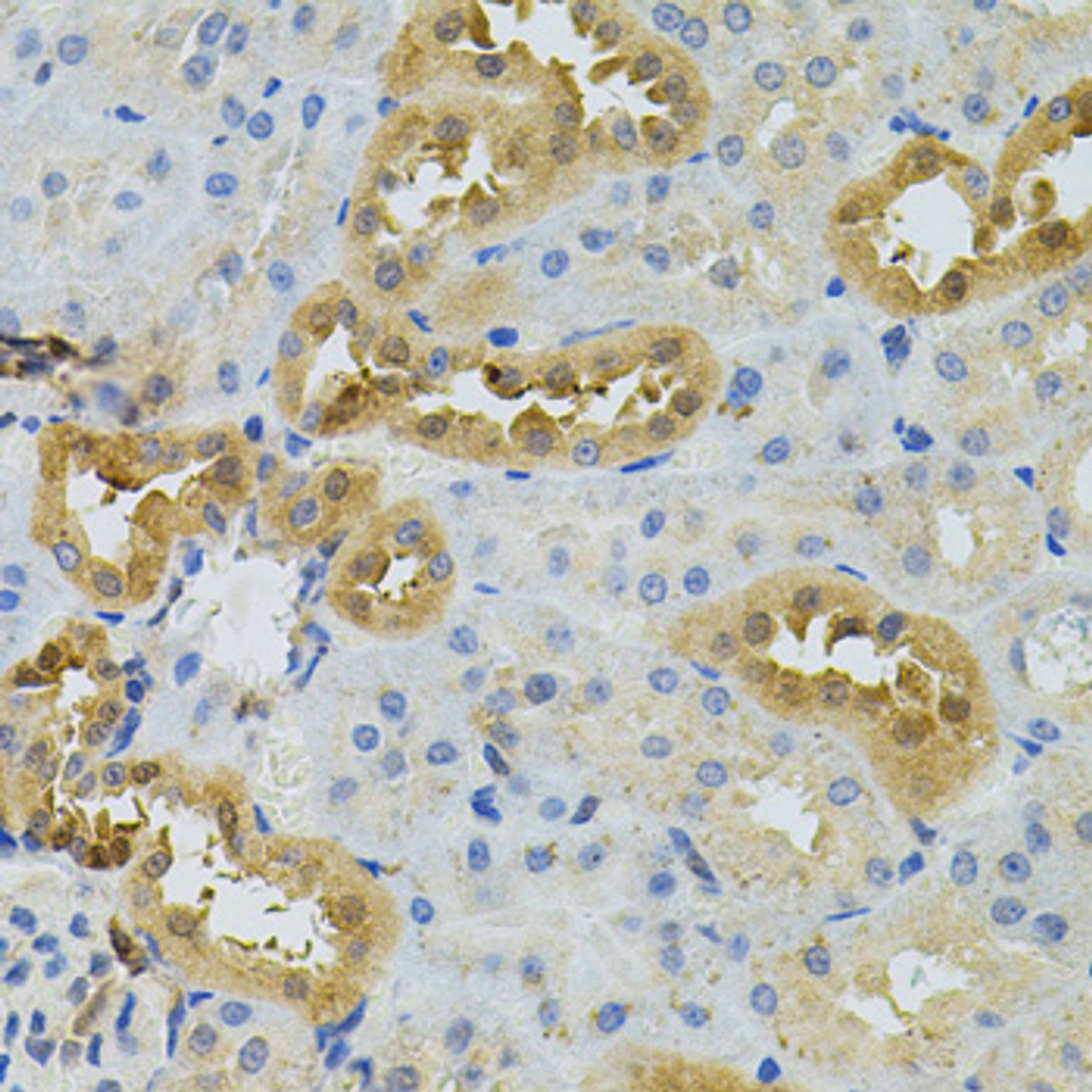 Immunohistochemistry of paraffin-embedded Rat kidney using NAT8 Polyclonal Antibody