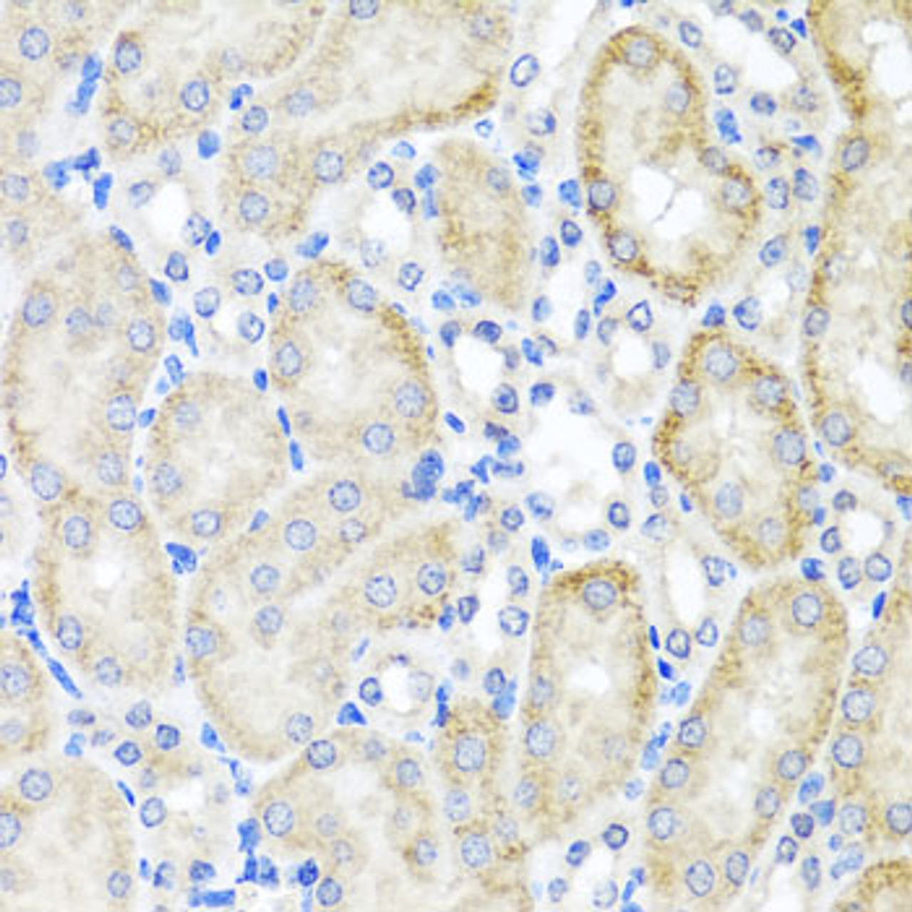 Immunohistochemistry of paraffin-embedded Mouse kidney using PSTPIP1 Polyclonal Antibody at dilution of  1:100 (40x lens).