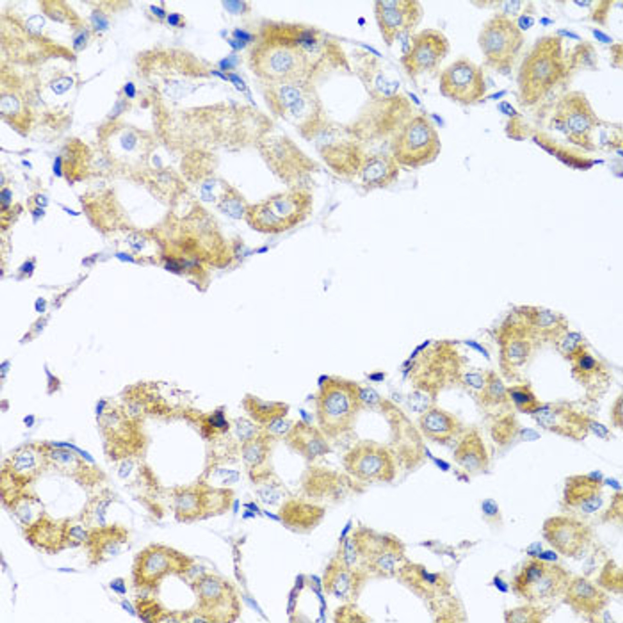 Immunohistochemistry of paraffin-embedded Human stomach using COQ7 Polyclonal Antibody at dilution of  1:100 (40x lens).