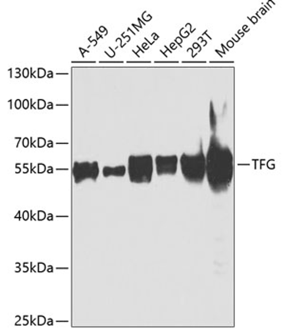 Western blot analysis of extracts of various cell lines using TFG Polyclonal Antibody at dilution of 1:1000.
