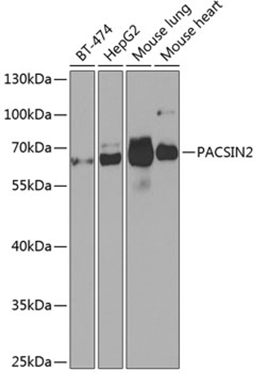 Western blot analysis of extracts of various cell lines using PACSIN2 Polyclonal Antibody at dilution of 1:1000.