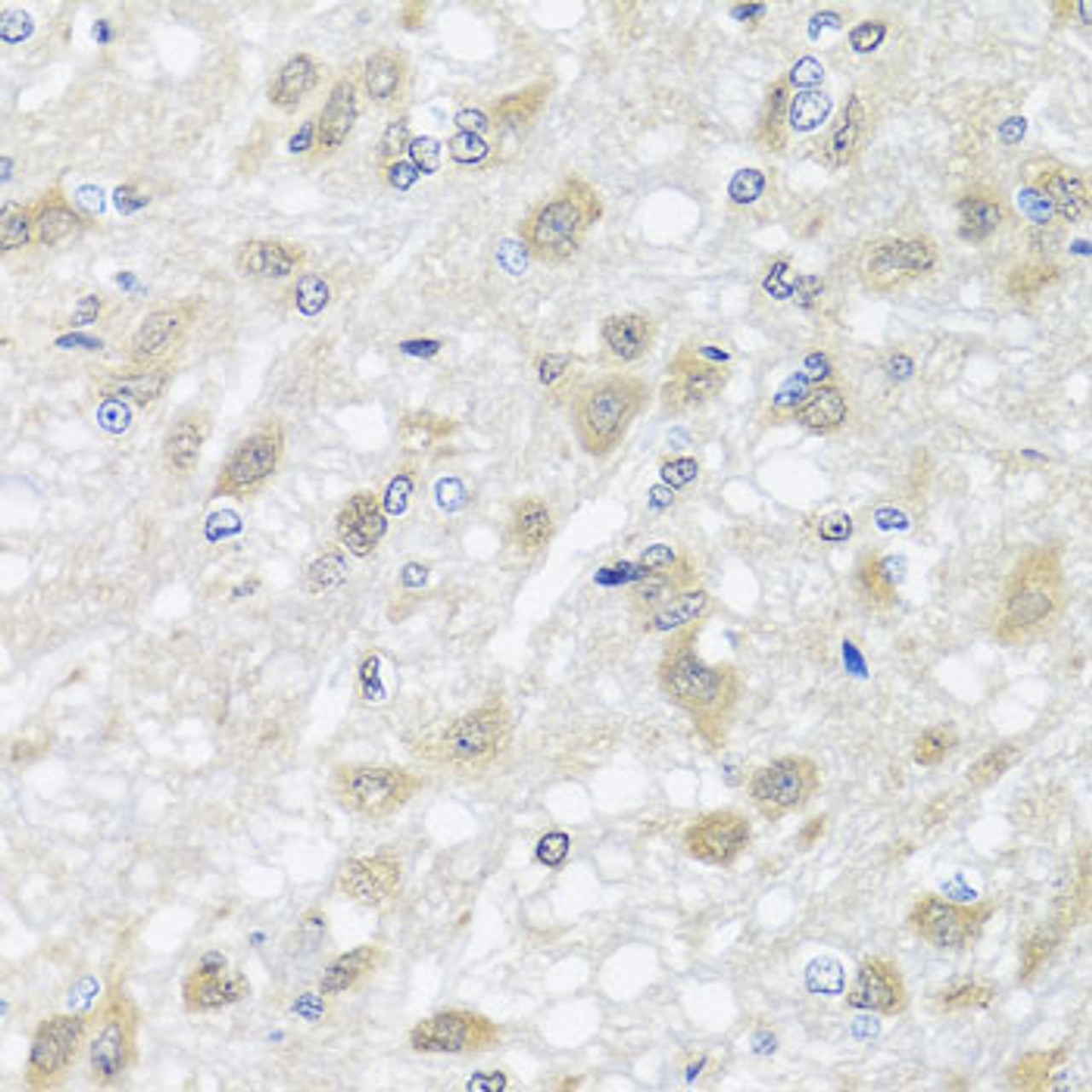 Immunohistochemistry of paraffin-embedded Rat brain using HARS2 Polyclonal Antibody at dilution of  1:100 (40x lens).