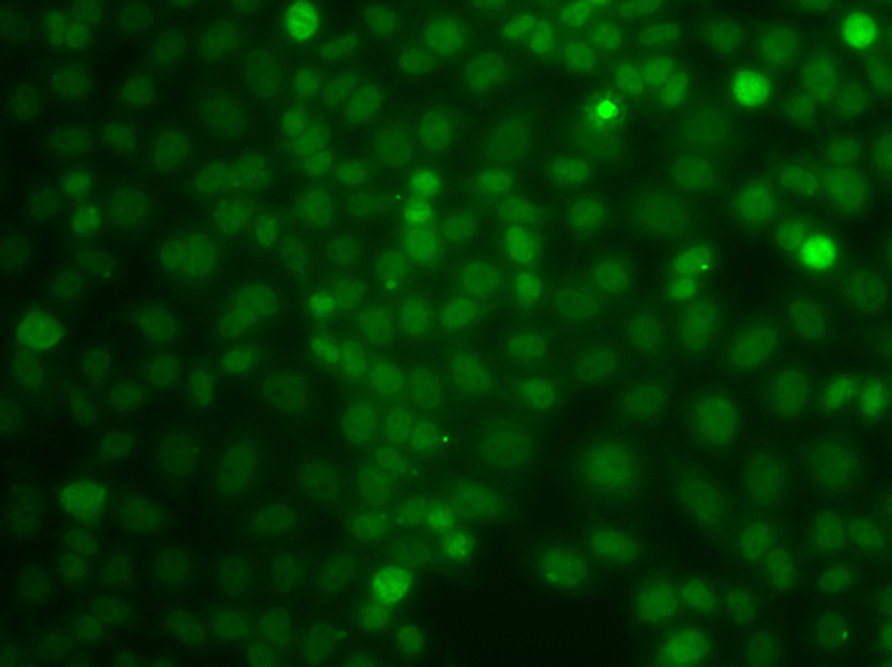 Immunofluorescence analysis of A549 cells using CBLC Polyclonal Antibody