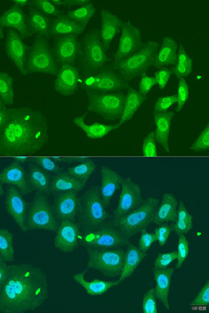 Immunofluorescence analysis of U2OS cells using MLH3 Polyclonal Antibody at dilution of  1:100. Blue: DAPI for nuclear staining.