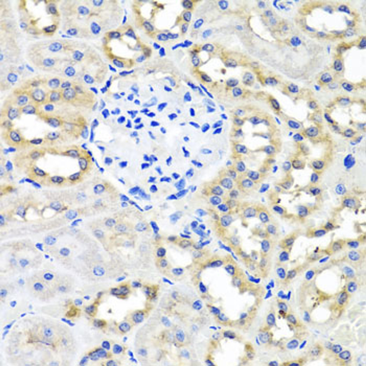 Immunohistochemistry of paraffin-embedded Rat kidney using SCG3 Polyclonal Antibody at dilution of  1:100 (40x lens).