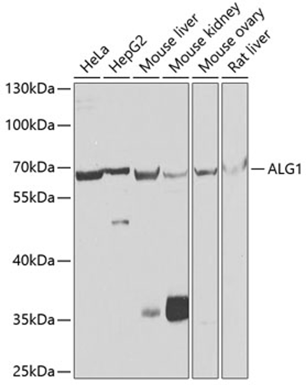 Western blot analysis of extracts of various cell lines using ALG1 Polyclonal Antibody at dilution of 1:1000.