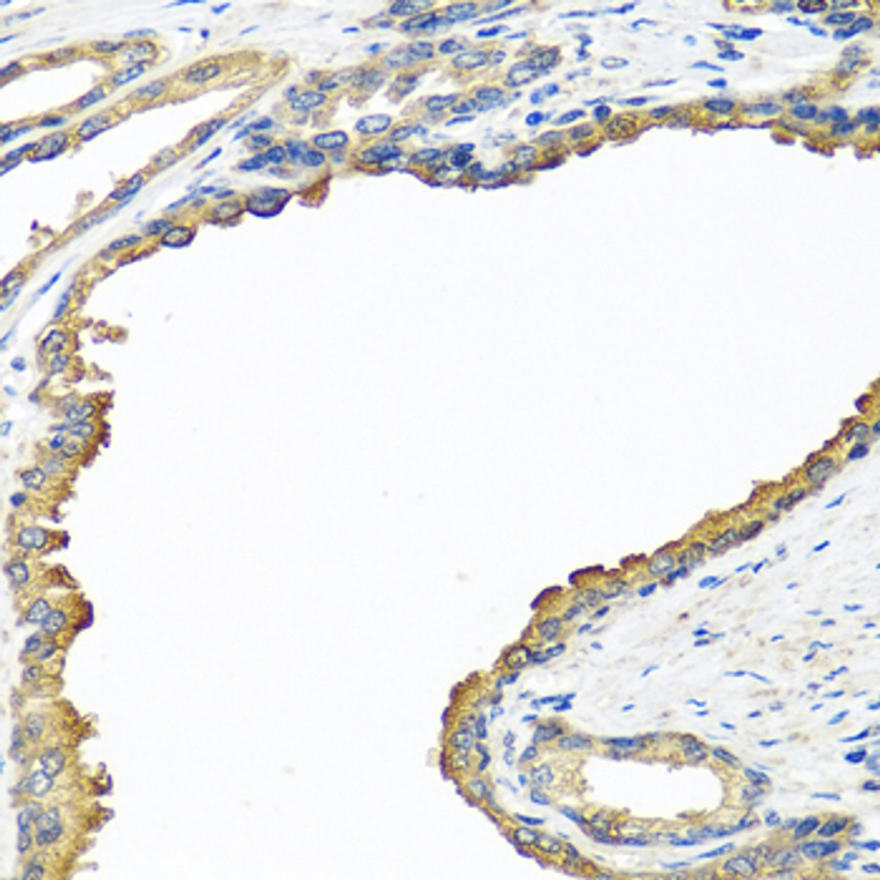 Immunohistochemistry of paraffin-embedded Human prostate using NYX Polyclonal Antibody at dilution of  1:100 (40x lens).
