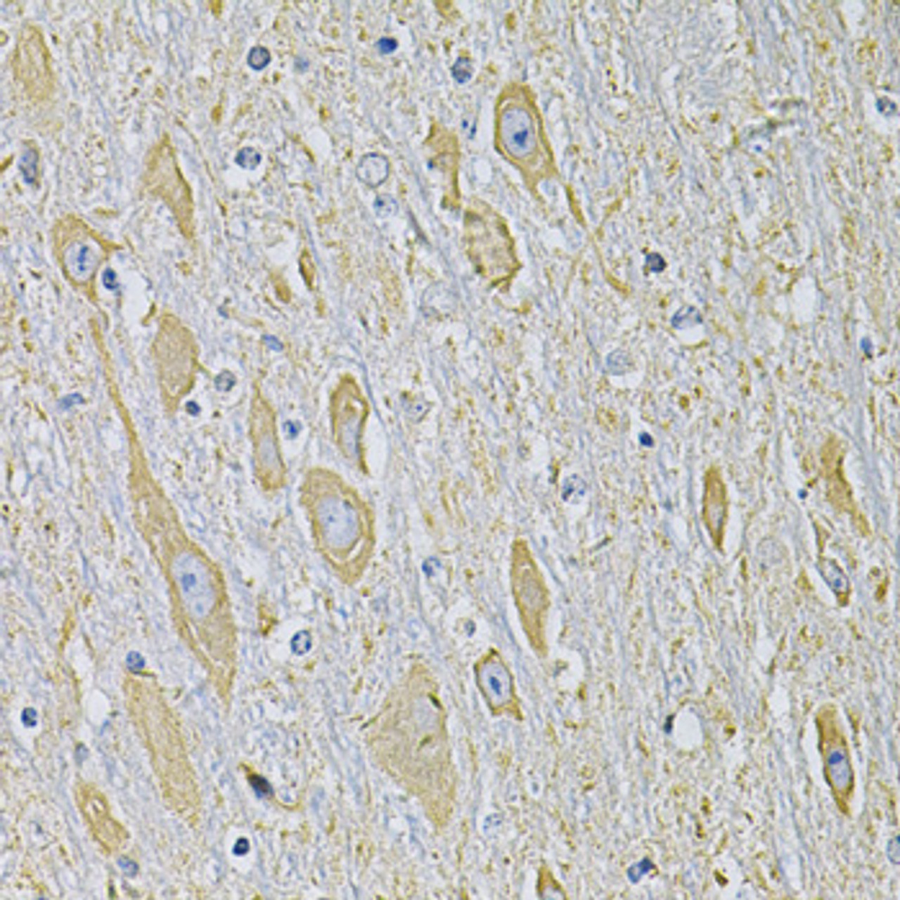 Immunohistochemistry of paraffin-embedded Mouse brain using RAB17 Polyclonal Antibody at dilution of  1:100 (40x lens).