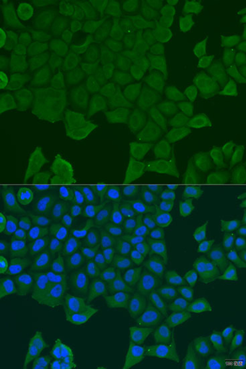 Immunofluorescence analysis of U2OS cells using REEP1 Polyclonal Antibody at dilution of  1:100. Blue: DAPI for nuclear staining.