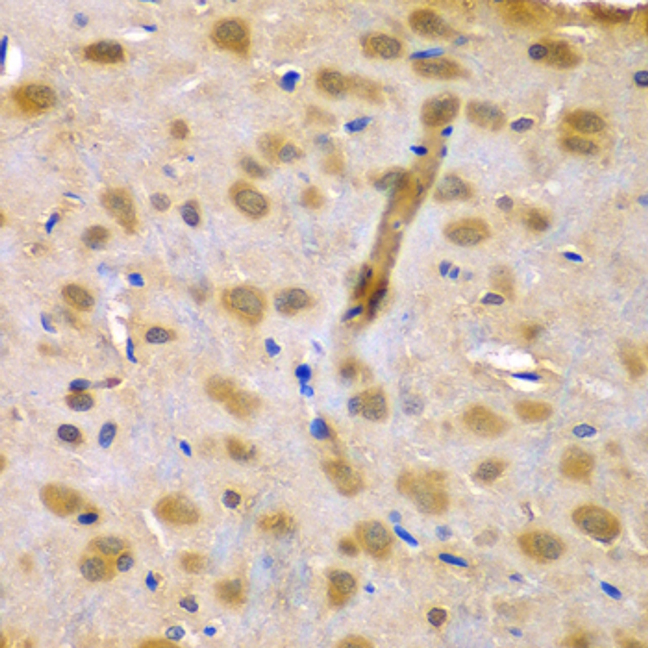 Immunohistochemistry of paraffin-embedded Rat brain using RUFY1 Polyclonal Antibody at dilution of  1:100 (40x lens).