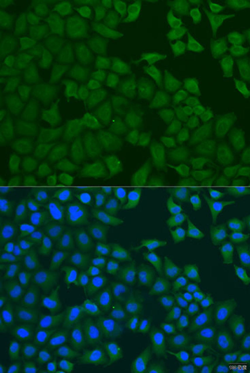 Immunofluorescence analysis of U2OS cells using FERMT3 Polyclonal Antibody at dilution of  1:100. Blue: DAPI for nuclear staining.