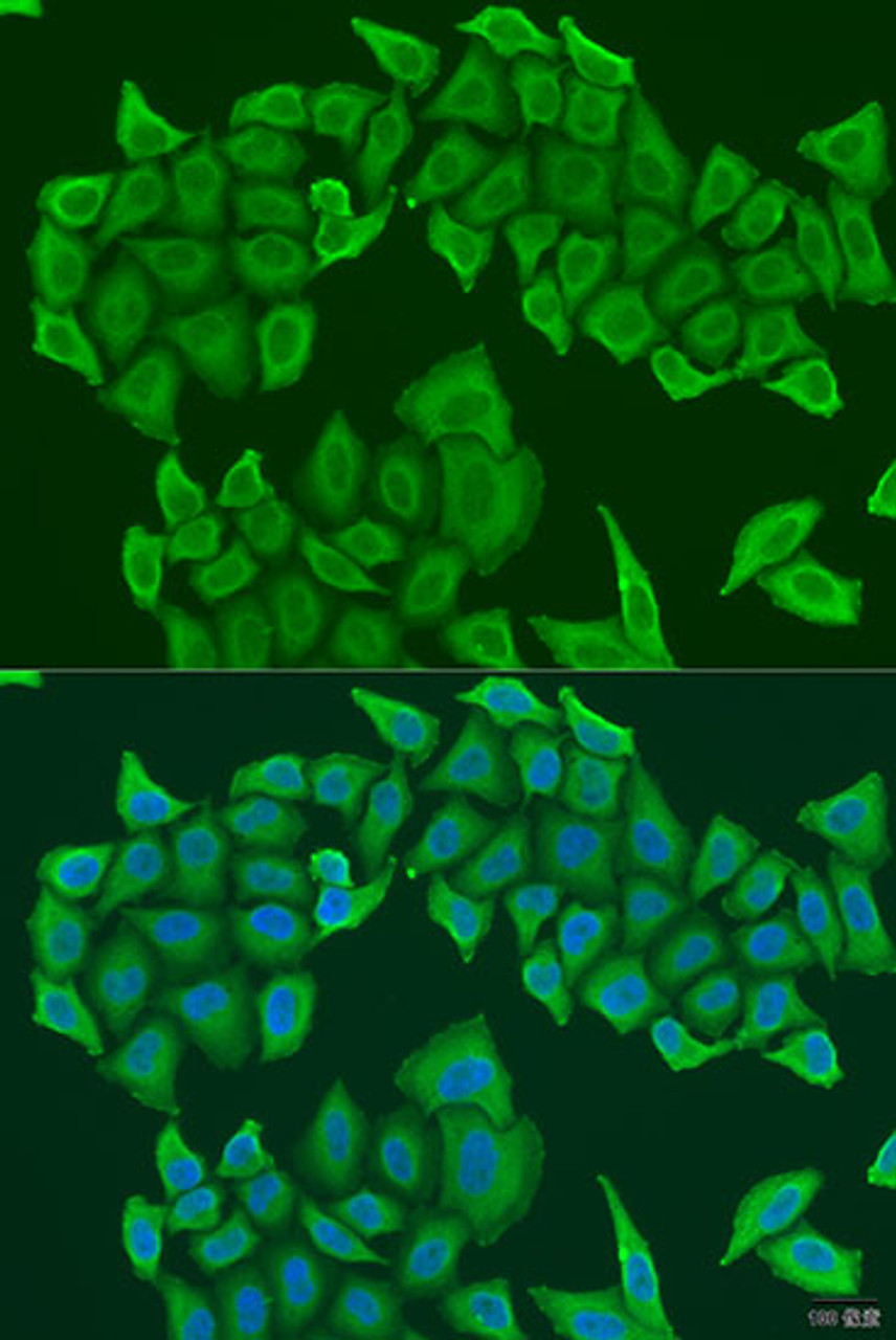 Immunofluorescence analysis of U2OS cells using HAUS8 Polyclonal Antibody at dilution of  1:100. Blue: DAPI for nuclear staining.