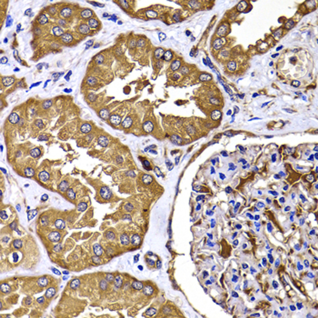 Immunohistochemistry of paraffin-embedded Human kidney using TGS1 Polyclonal Antibody at dilution of  1:100 (40x lens).