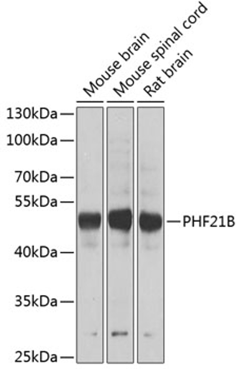 Western blot analysis of extracts of various cell lines using PHF21B Polyclonal Antibody at dilution of 1:1000.