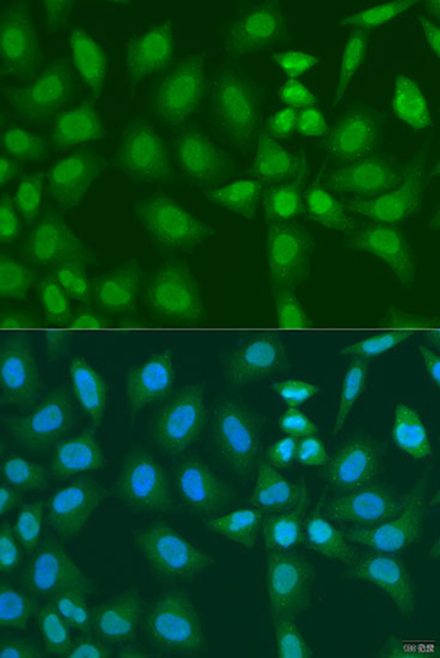 Immunofluorescence analysis of U2OS cells using PHF21B Polyclonal Antibody at dilution of  1:100. Blue: DAPI for nuclear staining.