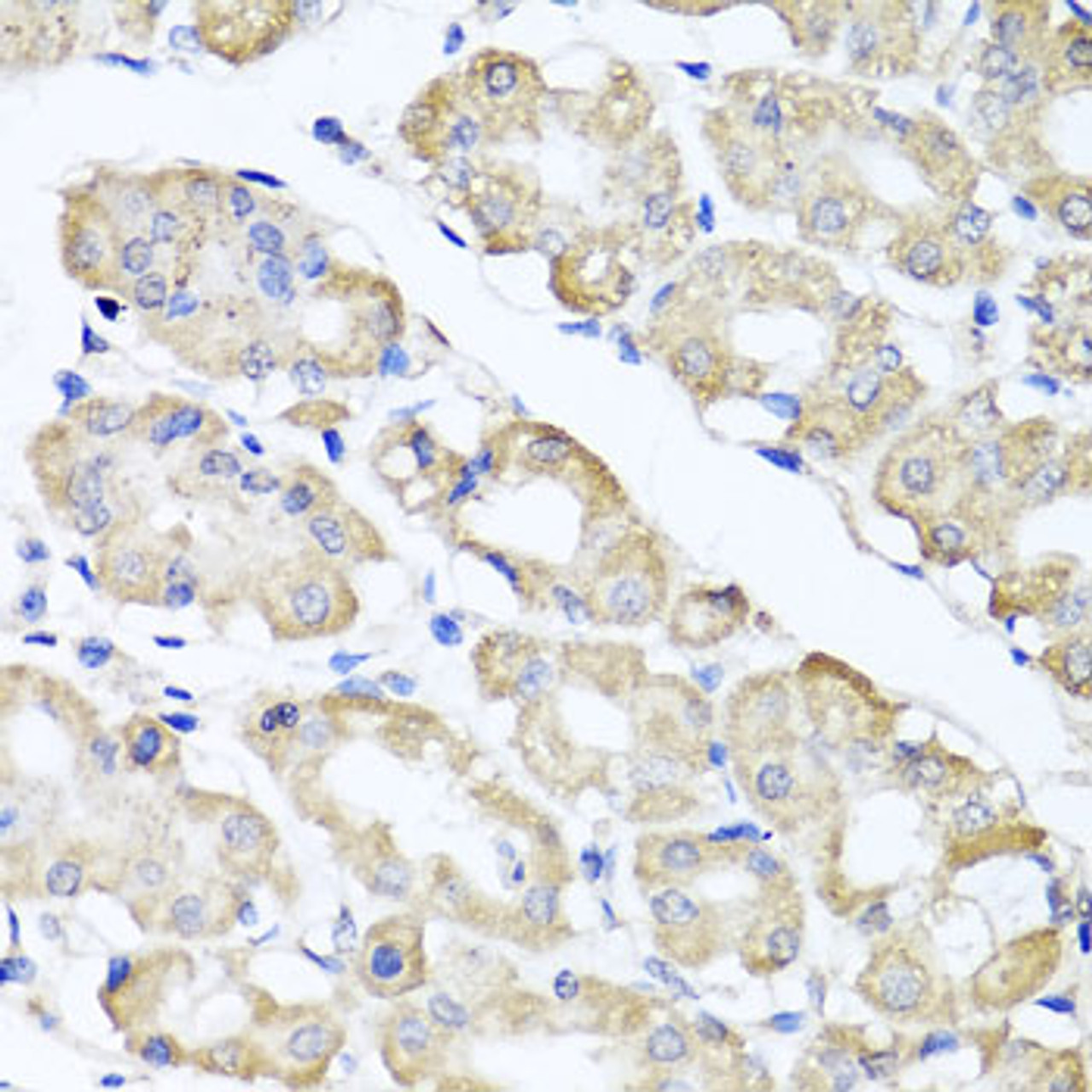 Immunohistochemistry of paraffin-embedded Human stomach using SPICE1 Polyclonal Antibody at dilution of  1:100 (40x lens).