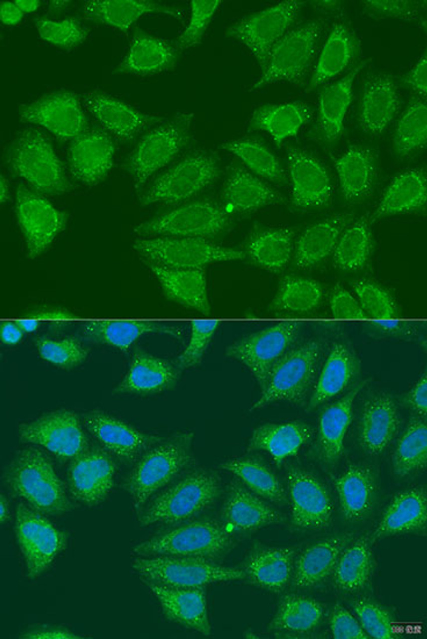 Immunofluorescence analysis of U2OS cells using ADH7 Polyclonal Antibody at dilution of  1:100. Blue: DAPI for nuclear staining.