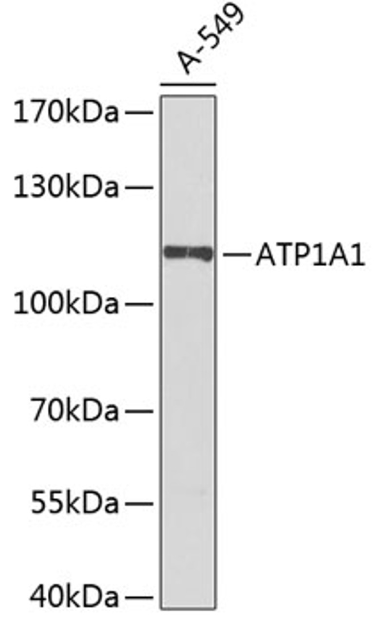 Western blot analysis of extracts of A-549 cells using ATP1A1 Polyclonal Antibody at dilution of 1:1000.