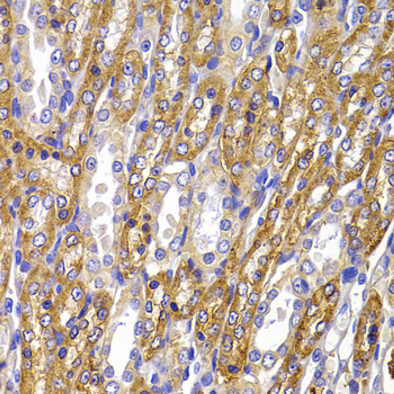Immunohistochemistry of paraffin-embedded Rat kidney using ATP1A1 Polyclonal Antibody at dilution of  1:100 (40x lens).