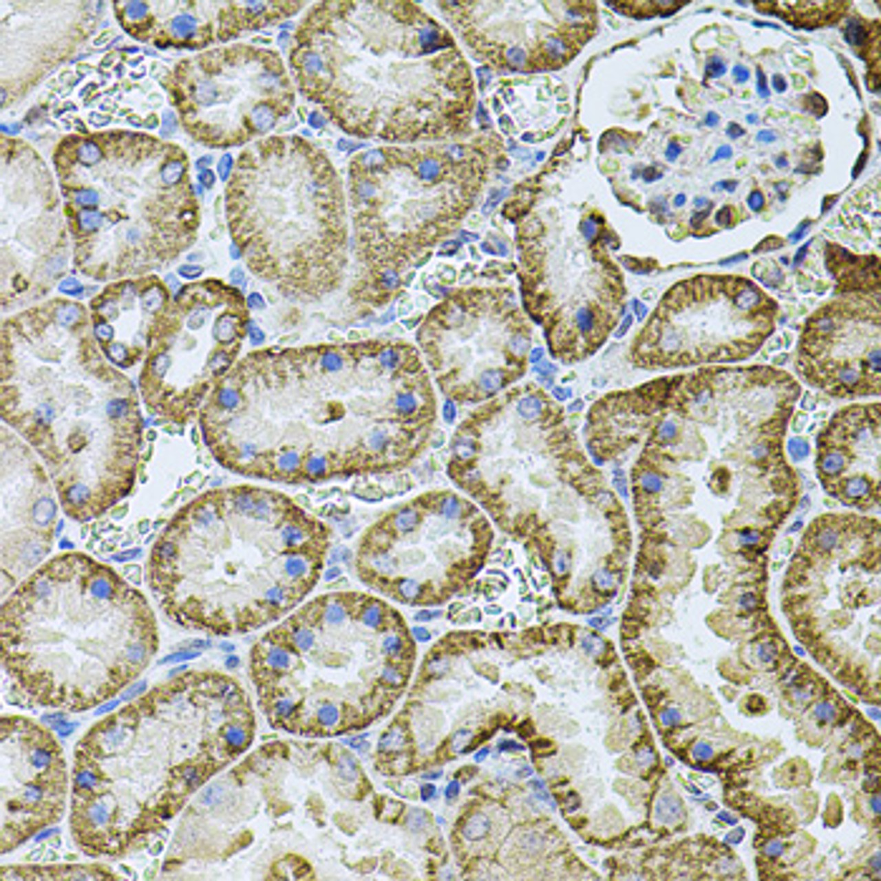 Immunohistochemistry of paraffin-embedded Rat kidney using CDH16 Polyclonal Antibody at dilution of  1:100 (40x lens).