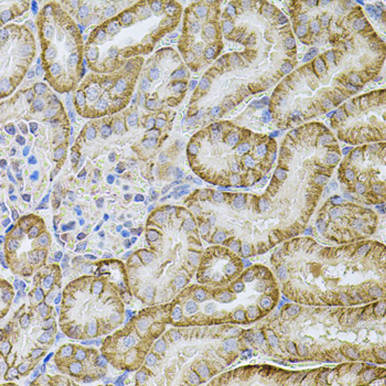Immunohistochemistry of paraffin-embedded Mouse kidney using CDH16 Polyclonal Antibody at dilution of  1:100 (40x lens).