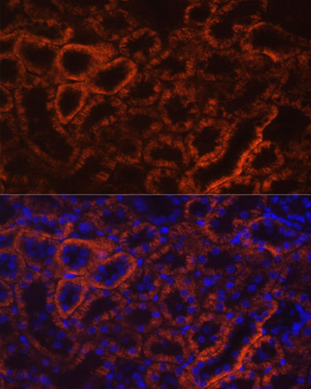 Immunofluorescence analysis of Rat kidney using CDH16 Polyclonal Antibody at dilution of  1:100 (40x lens). Blue: DAPI for nuclear staining.