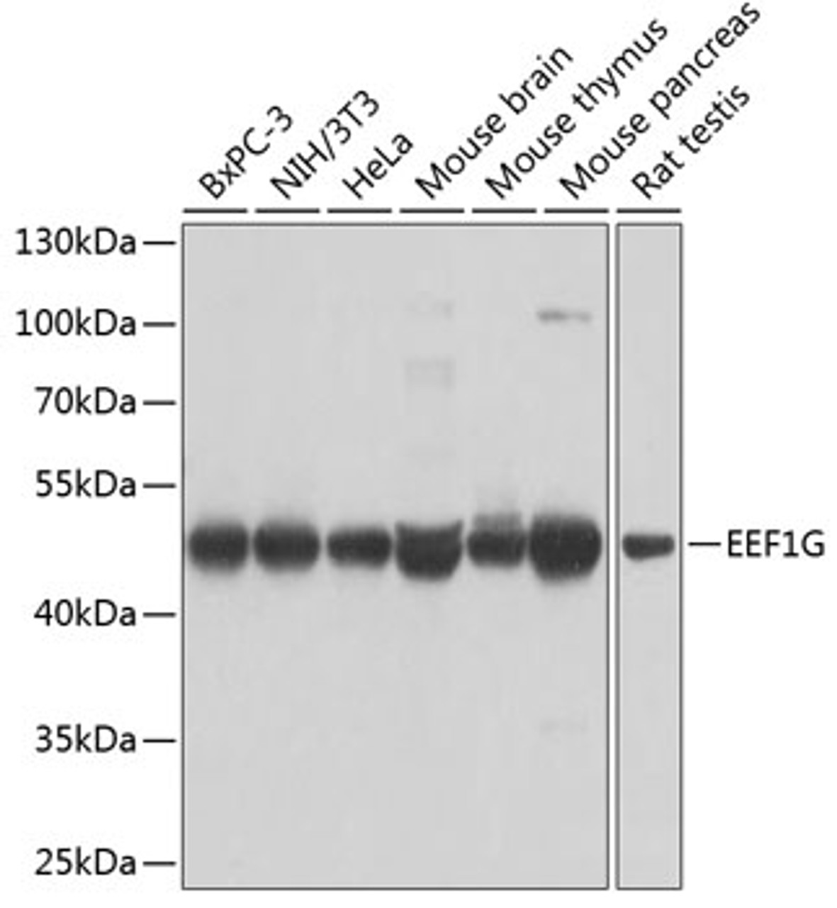 Western blot analysis of extracts of various cell lines using EEF1G Polyclonal Antibody at dilution of 1:1000.