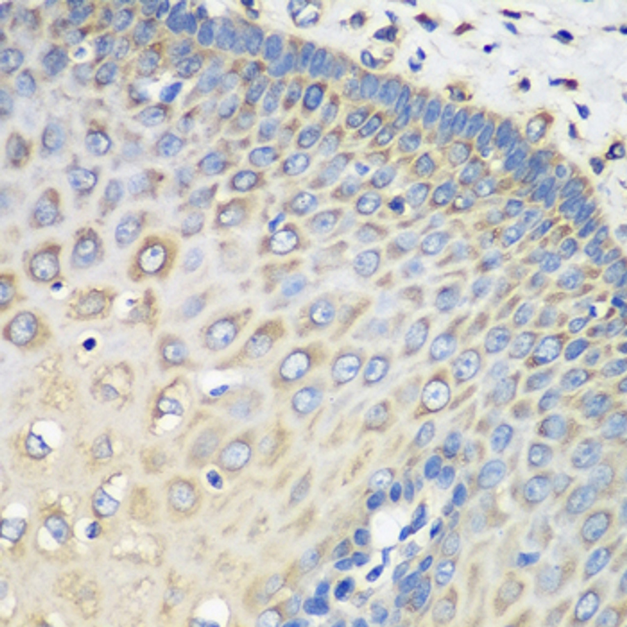 Immunohistochemistry of paraffin-embedded Human esophagus using EEF1G Polyclonal Antibody at dilution of  1:100 (40x lens).