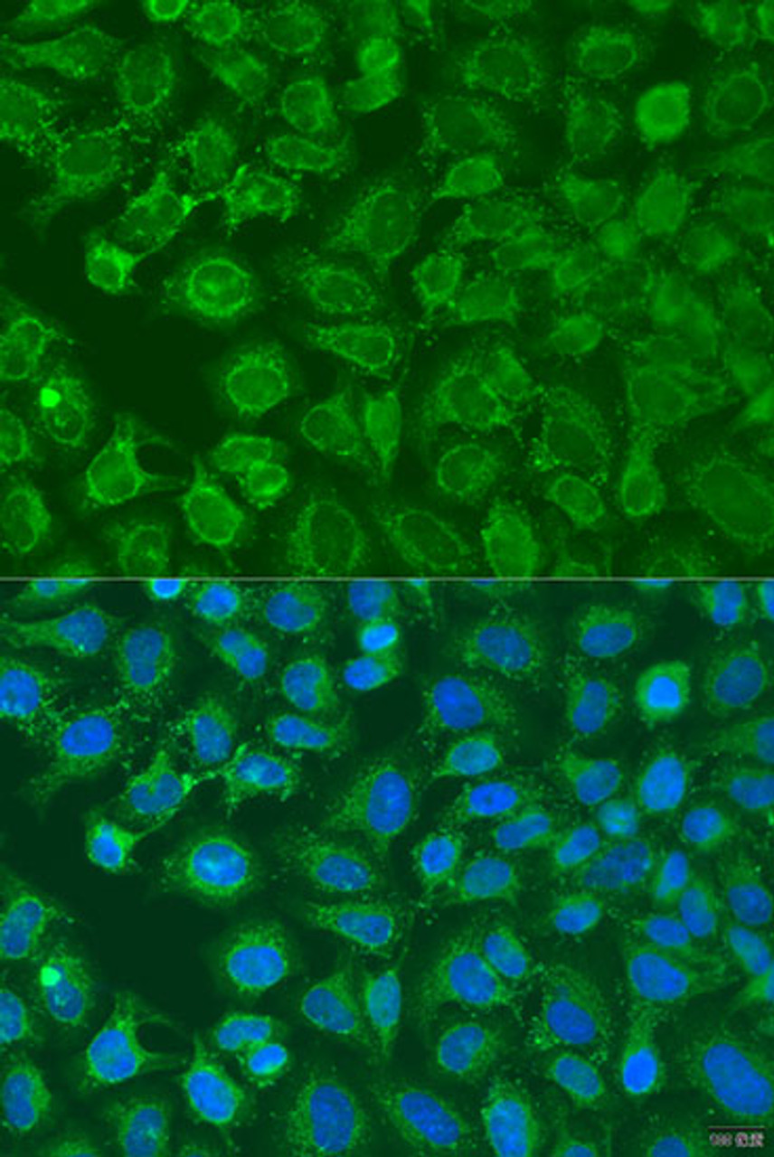 Immunofluorescence analysis of U2OS cells using EIF2B1 Polyclonal Antibody at dilution of  1:100. Blue: DAPI for nuclear staining.