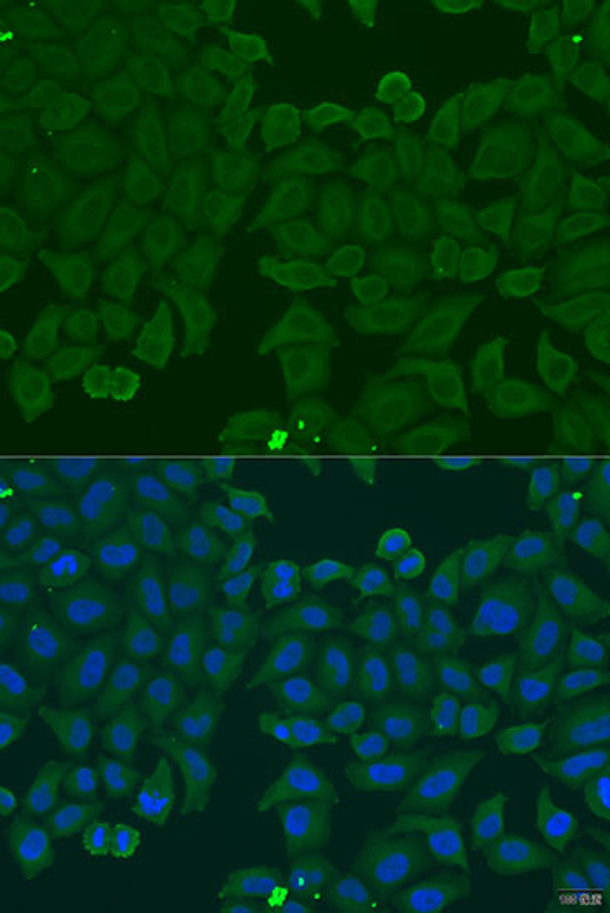 Immunofluorescence analysis of U2OS cells using IFNA6 Polyclonal Antibody at dilution of  1:100. Blue: DAPI for nuclear staining.