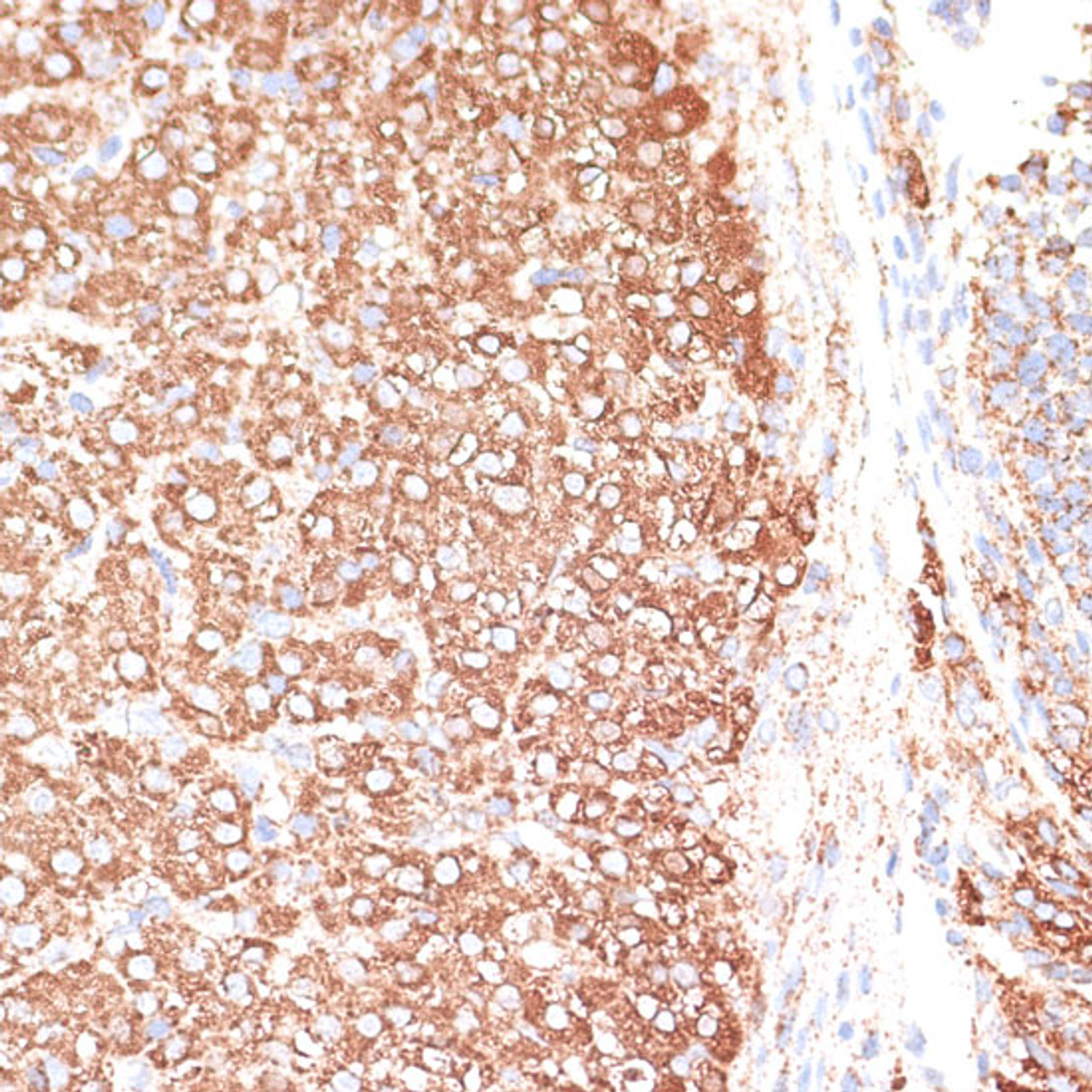 Immunohistochemistry of paraffin-embedded Rat ovary using KCNS3 Polyclonal Antibody at dilution of  1:100 (40x lens).