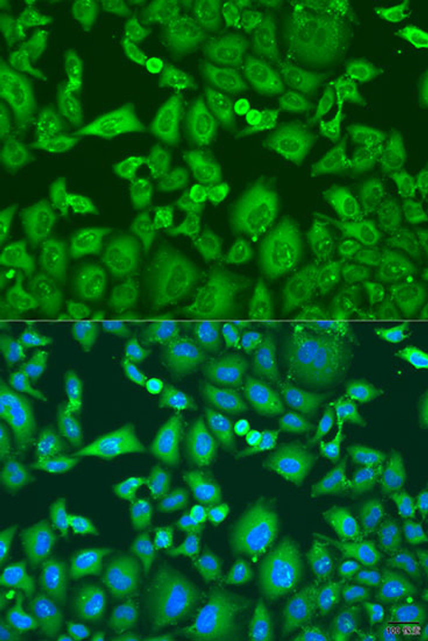 Immunofluorescence analysis of U2OS cells using KIF11 Polyclonal Antibody at dilution of  1:100. Blue: DAPI for nuclear staining.