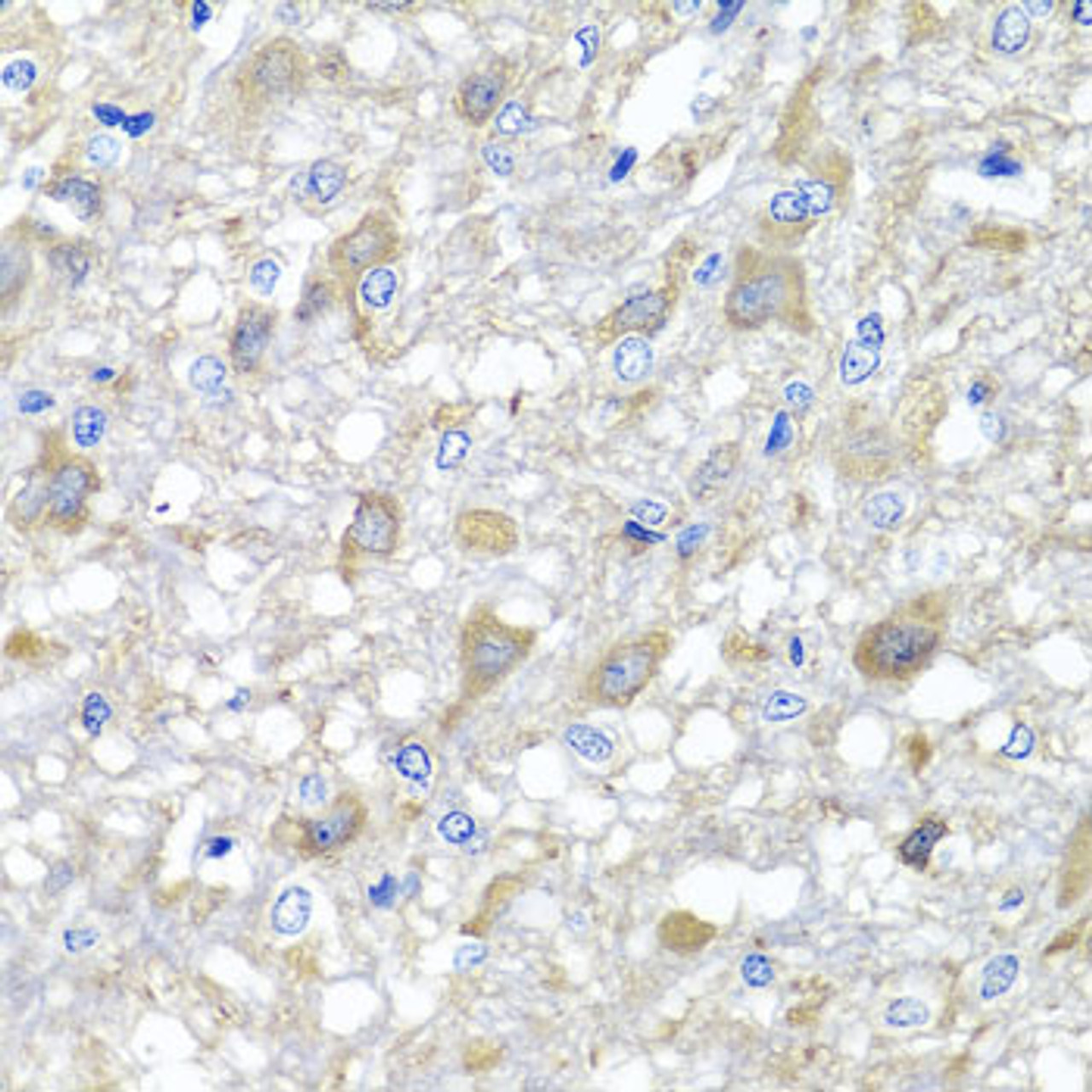 Immunohistochemistry of paraffin-embedded Rat brain using MTX1 Polyclonal Antibody at dilution of  1:100 (40x lens).