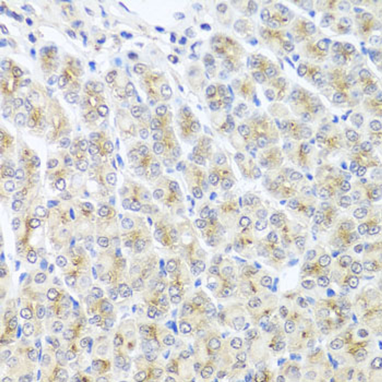 Immunohistochemistry of paraffin-embedded Mouse stomach using MTX1 Polyclonal Antibody at dilution of  1:100 (40x lens).