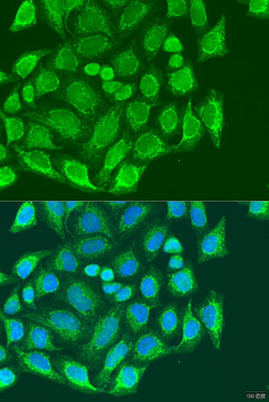 Immunofluorescence analysis of U2OS cells using MTX1 Polyclonal Antibody at dilution of  1:100. Blue: DAPI for nuclear staining.