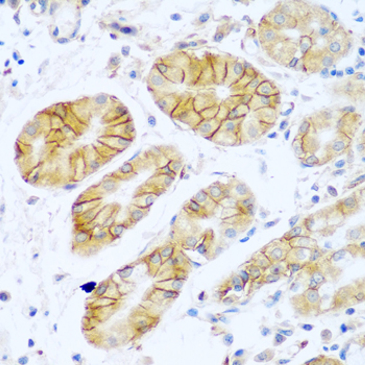 Immunohistochemistry of paraffin-embedded Human stomach using NCAM1 / CD56 Polyclonal Antibody at dilution of  1:100 (40x lens).