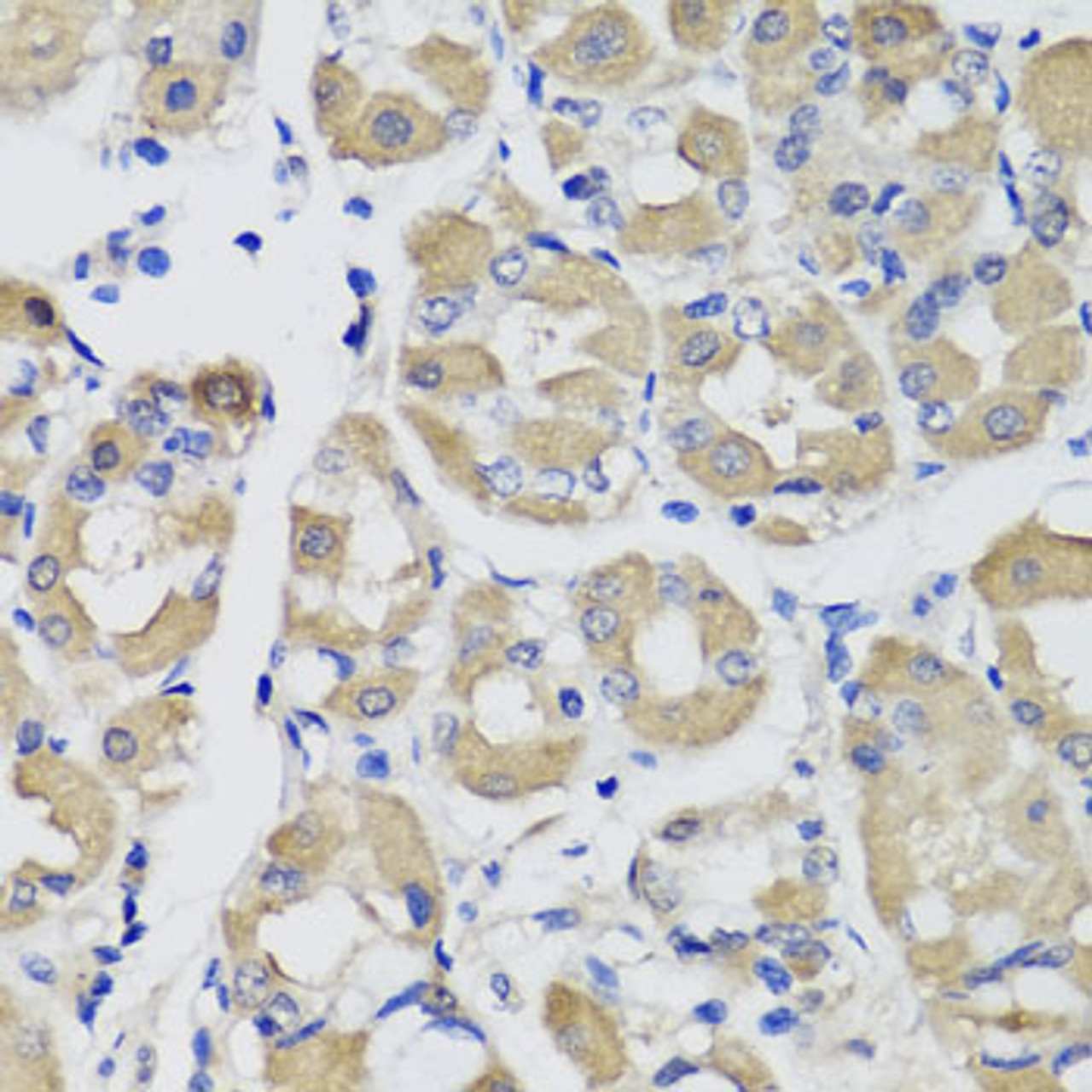 Immunohistochemistry of paraffin-embedded Human stomach using PSPH Polyclonal Antibody at dilution of  1:100 (40x lens).